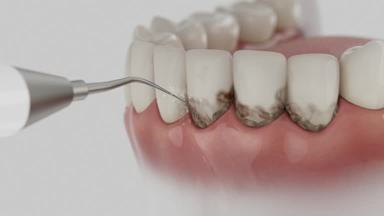 Trusted Dental Implants service in Jamestown, ND - Dentist Open Now